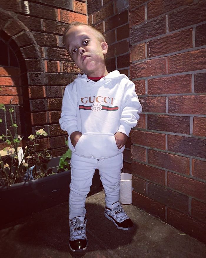 Celebrities Respond To 9-Year-Old Quaden Who Was Bullied Over His Dwarfism So Bad, He Wanted To Die Celebrities Respond To 9-Year-Old Quaden Who Was Bullied Over His Dwarfism So Bad, He Wanted To Die