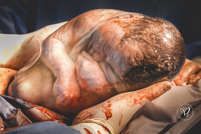 Honorable Mention: "Milagre Da Vida", Jana Brasil