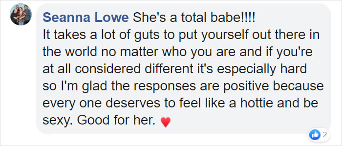 Disabled Woman Nervously Shares Her “Sexy” Photos And Twitter Falls In Love With Her Disabled Woman Nervously Shares Her “Sexy” Photos And Twitter Falls In Love With Her