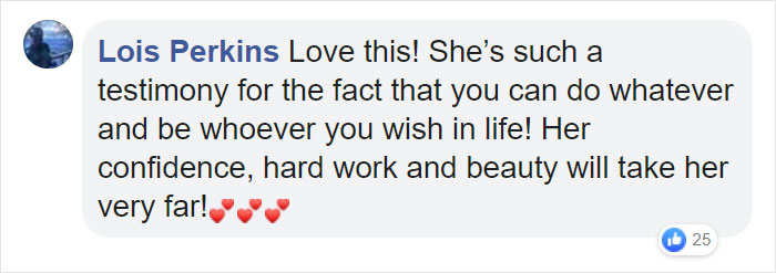 People Are Celebrating This Model With Down Syndrome Who Just Rocked New York Fashion Week People Are Celebrating This Model With Down Syndrome Who Just Rocked New York Fashion Week