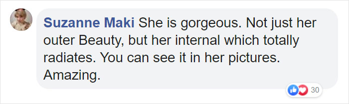 People Are Celebrating This Model With Down Syndrome Who Just Rocked New York Fashion Week People Are Celebrating This Model With Down Syndrome Who Just Rocked New York Fashion Week