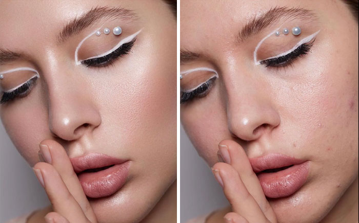 Skin Online vs. Skin Irl