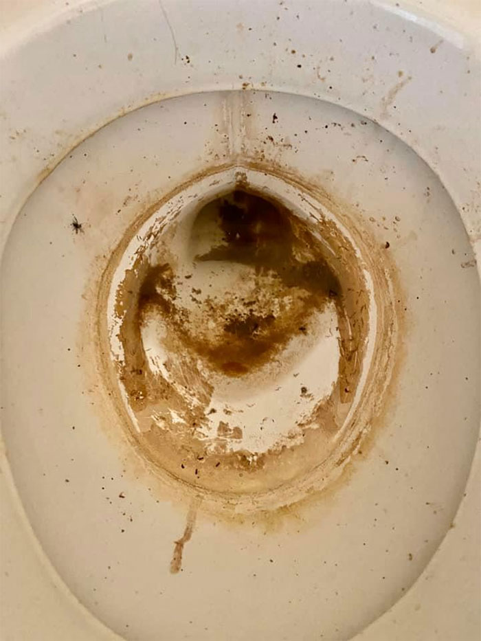 People Wonder Why Rents And Security Deposits Are So High, So This Landlord Shares Some Pics