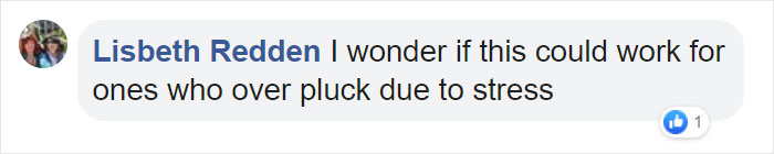 Vet Gives Parrot New Wings After Someone Severely Trims Them