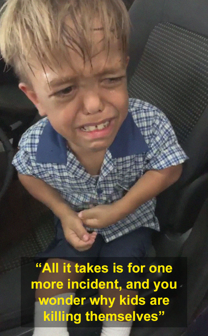 Celebrities Respond To 9-Year-Old Quaden Who Was Bullied Over His Dwarfism So Bad, He Wanted To Die Celebrities Respond To 9-Year-Old Quaden Who Was Bullied Over His Dwarfism So Bad, He Wanted To Die