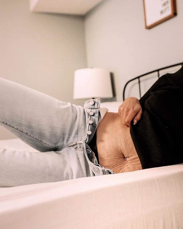 Someone Makes A Post About Strong Women Who Celebrate Their Natural Bodies, Illustrates It With The Perfect Example