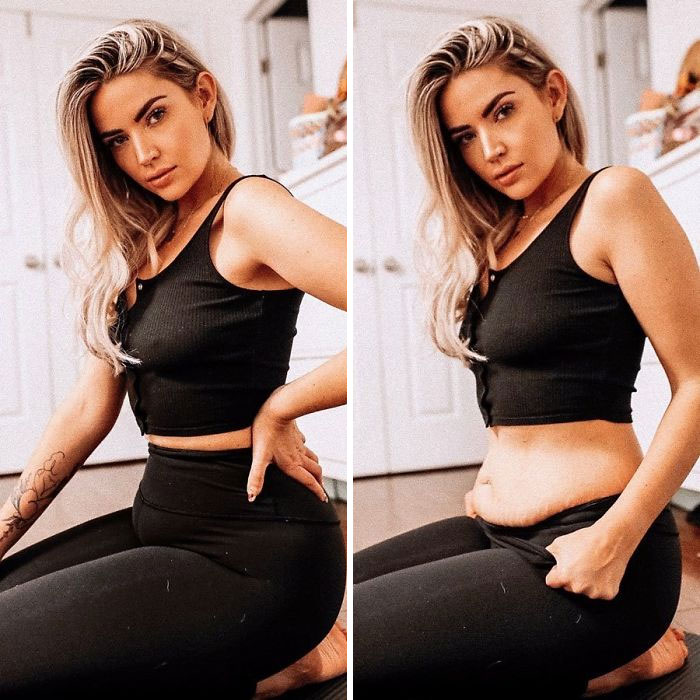 Someone Makes A Post About Strong Women Who Celebrate Their Natural Bodies, Illustrates It With The Perfect Example Someone Makes A Post About Strong Women Who Celebrate Their Natural Bodies, Illustrates It With The Perfect Example