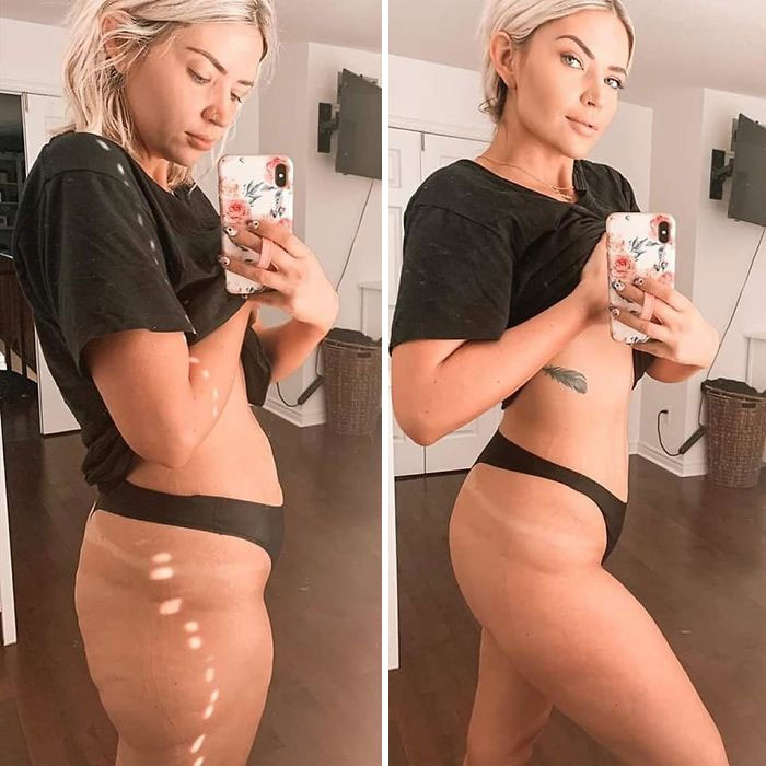 Someone Makes A Post About Strong Women Who Celebrate Their Natural Bodies, Illustrates It With The Perfect Example Someone Makes A Post About Strong Women Who Celebrate Their Natural Bodies, Illustrates It With The Perfect Example