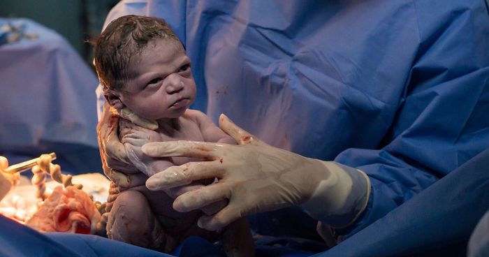 Baby Girl Stares Doctors Down Moments After Being Born, Mom Says She Was ‘Born A Ready Meme’