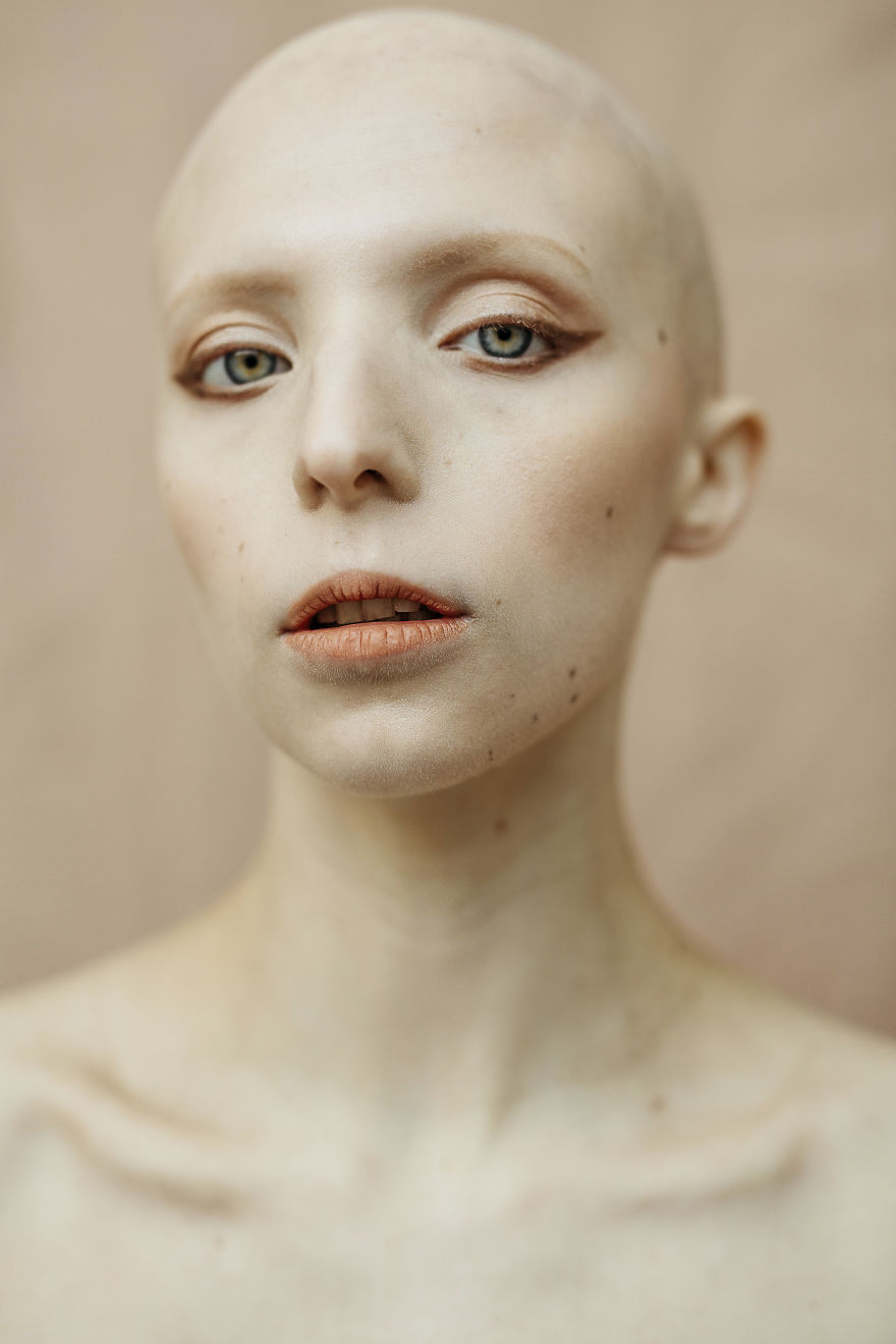 For This International Women‘s Day We Did A Special Photoshoot With Women That Represent People With Disabilities And Visible Differences For This International Women‘s Day We Did A Special Photoshoot With Women That Represent People With Disabilities And Visible Differences