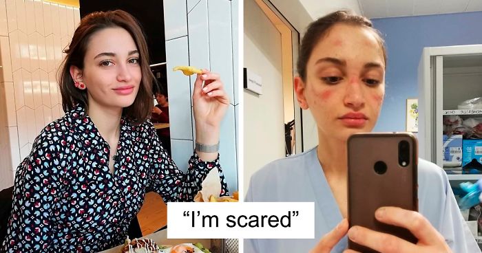 Nurse Treating Coronavirus Patients In Italy Shares How Hard It Is With A Heartbreaking Pic