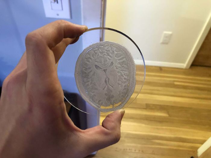 I’m Making Personalized Coasters Of All My Coworkers’ Brain Scans