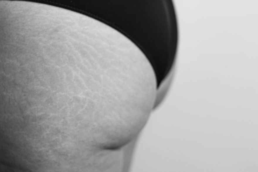 I've Photographed Women's Bodies To Show Them That Their "Complexes" Are Beautiful