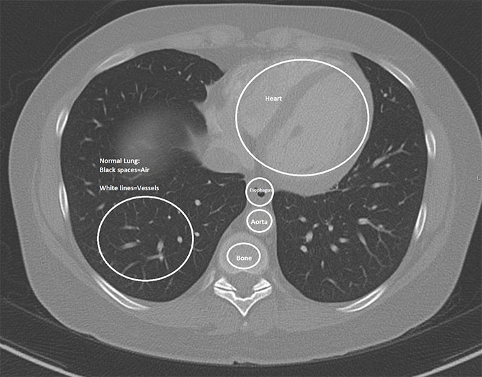 Angry Radiologist Asks To Share His Message After A Potential Coronavirus Carrier Takes A Plane Full Of People Angry Radiologist Asks To Share His Message After A Potential Coronavirus Carrier Takes A Plane Full Of People