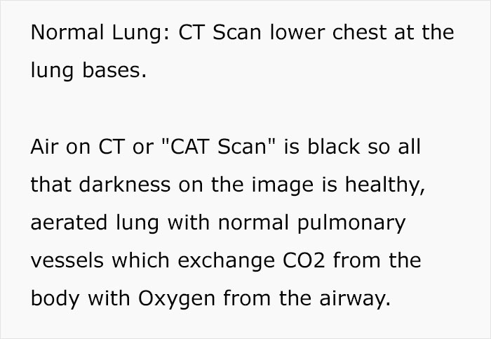 Angry Radiologist Asks To Share His Message After A Potential Coronavirus Carrier Takes A Plane Full Of People Angry Radiologist Asks To Share His Message After A Potential Coronavirus Carrier Takes A Plane Full Of People