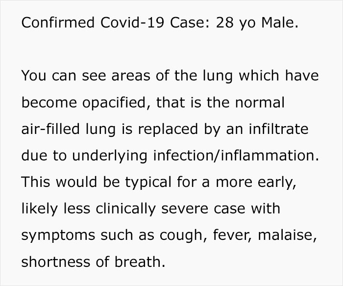 Angry Radiologist Asks To Share His Message After A Potential Coronavirus Carrier Takes A Plane Full Of People Angry Radiologist Asks To Share His Message After A Potential Coronavirus Carrier Takes A Plane Full Of People