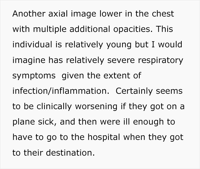Angry Radiologist Asks To Share His Message After A Potential Coronavirus Carrier Takes A Plane Full Of People Angry Radiologist Asks To Share His Message After A Potential Coronavirus Carrier Takes A Plane Full Of People