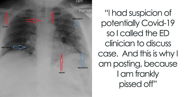 Angry Radiologist Asks To Share His Message After A Potential Coronavirus Carrier Takes A Plane Full Of People