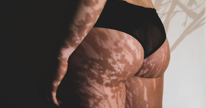 I’ve Photographed Women’s Bodies To Show Them That Their “Complexes” Are Beautiful