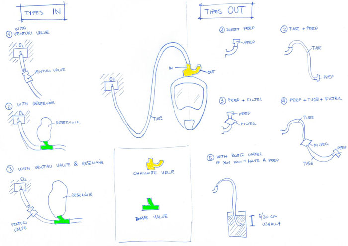 Italian Engineers Turn Snorkeling Masks Into Life-Saving Ventilators