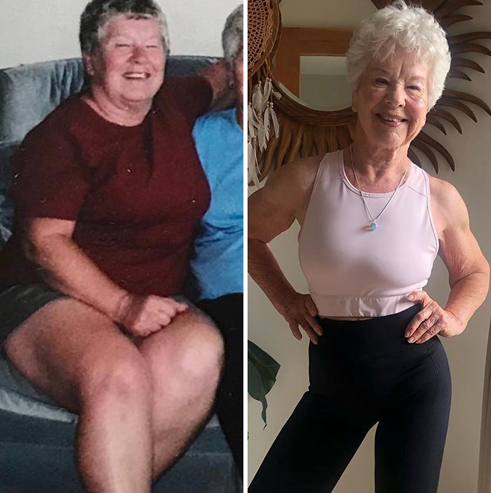 Daughter Helps 73-Year-Old Mom Lose 50+ Pounds To Get Her Health Back On Track, And Her Before And After Pics Go Viral
