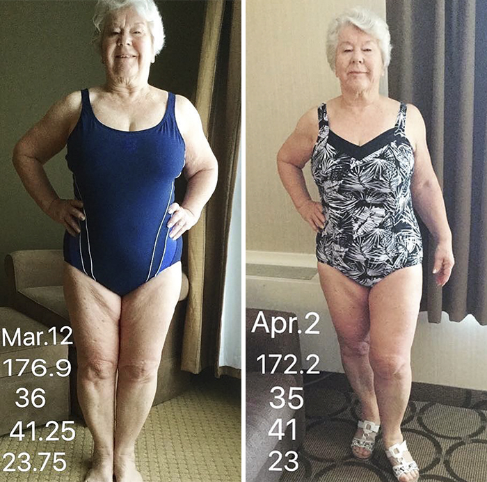 Daughter Helps 73-Year-Old Mom Lose 50+ Pounds To Get Her Health Back On Track, And Her Before And After Pics Go Viral