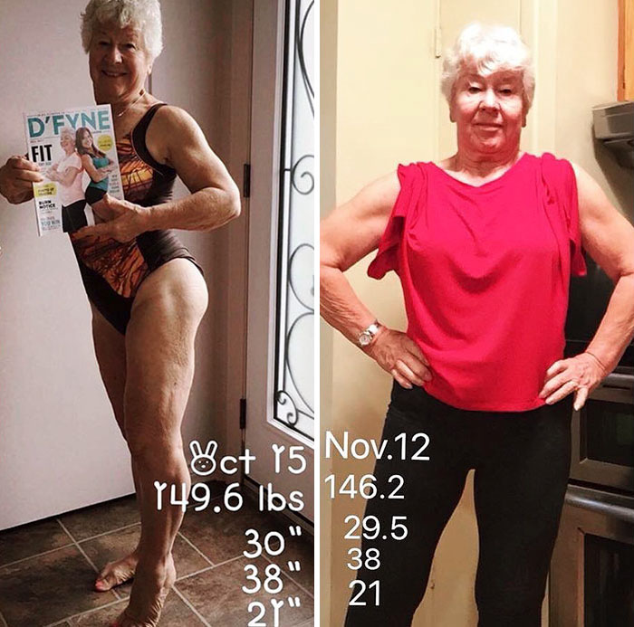 Daughter Helps 73-Year-Old Mom Lose 50+ Pounds To Get Her Health Back On Track, And Her Before And After Pics Go Viral Daughter Helps 73-Year-Old Mom Lose 50+ Pounds To Get Her Health Back On Track, And Her Before And After Pics Go Viral