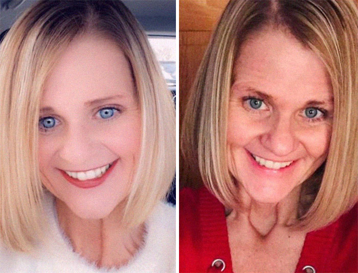 I Think She Just Discovered Facetune. (Right Is A Normal Selfie)