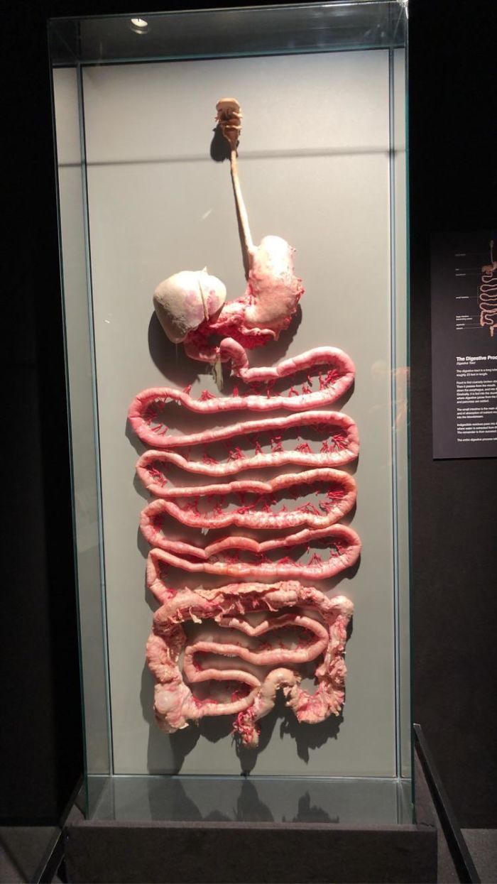 Entire GI Tract Seen At The Body Worlds Exhibit At The Museum Of Science, Boston, MA