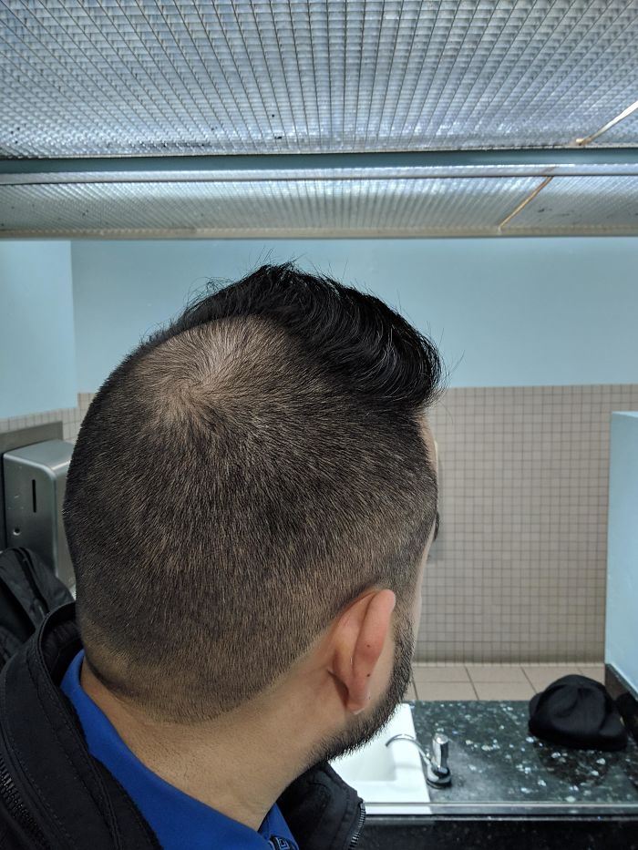 I Asked For A High Fade, And To Even Out The Top. This Is What I Got