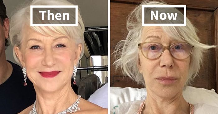 This Is What Days Of Self-Isolation Have Done To Celebrities (30 Pics)