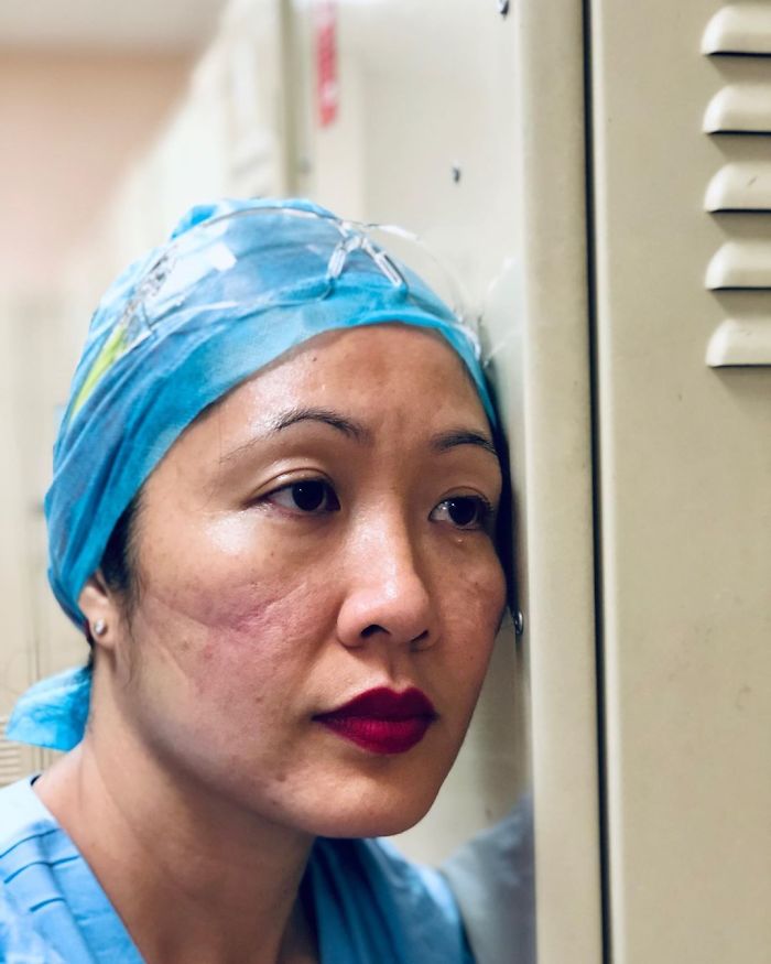 "See The Marks On My Face? Those Are The Marks Left By The N95 Mask That Divides Me And The Potential Covid-19 Patient"