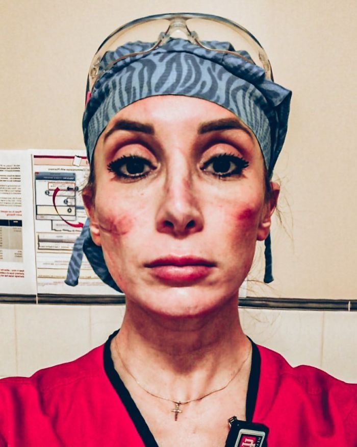 "This Is The Face Of A Covid Icu Nurse"