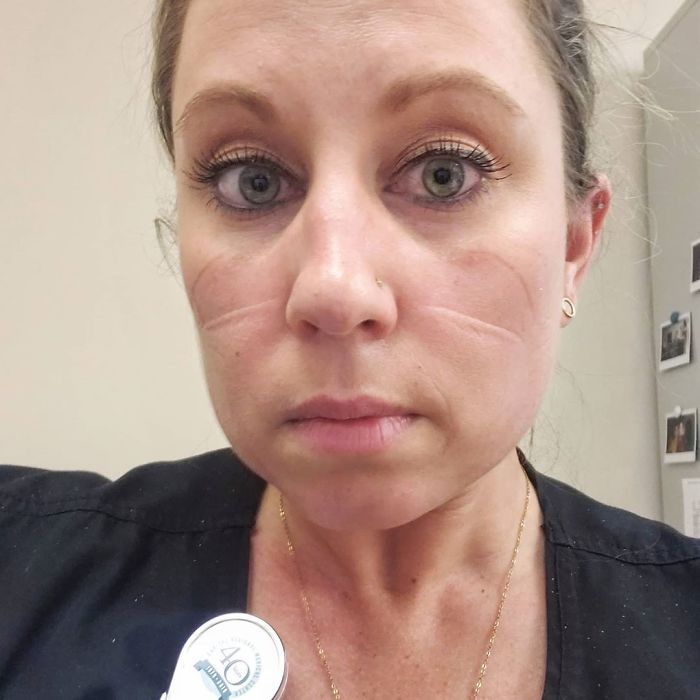 "After Just 45 Mins Of Wearing An N95 (Fitted Appropriately)...you're Sweating, Your Jaw Hurts, And Your Ears Are On Fire"