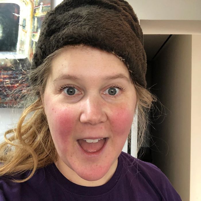 People Share Their Unfortunate Name Stories After Amy Schumer Changes Her Baby’s Name Because It Sounded Like “Genital” People Share Their Unfortunate Name Stories After Amy Schumer Changes Her Baby’s Name Because It Sounded Like “Genital”