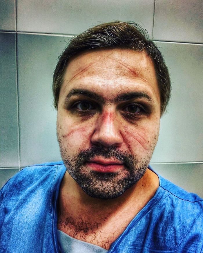 "I Am A Nurse (Rn) At Hospital Geral De Parelheiros In São Paulo, Brazil, I Graduated Since 2015 And Today I Am In An Icu With Only Patients With Covid 19"