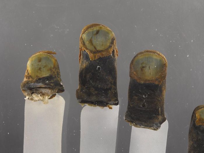 Frost-Bitten Finger Tips