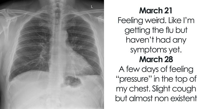 Man Details What It Really Feels Like To Have A ‘Mild’ Case Of Covid-19