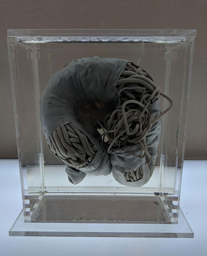 Preserved Intestinal Worms