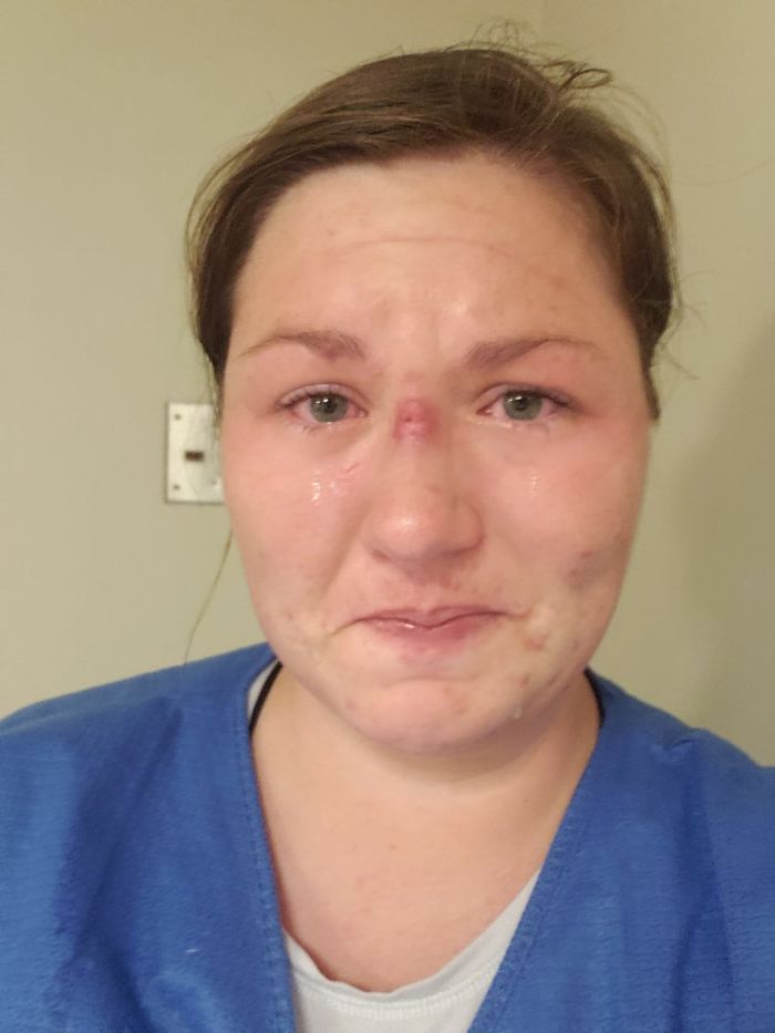 You Think Coronavirus Is Scary? This ICU Nurse’s Viral Post Shows It’s Worse Than You Imagine You Think Coronavirus Is Scary? This ICU Nurse’s Viral Post Shows It’s Worse Than You Imagine
