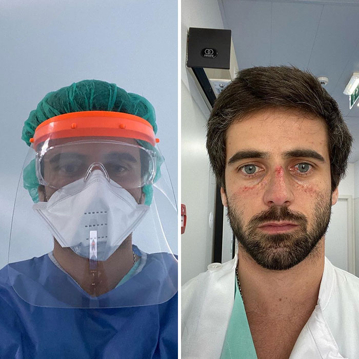 "The Covid Mask Effects. Please Stay Home And Protect The Ones You Love! Stay Safe, Stay Strong!"