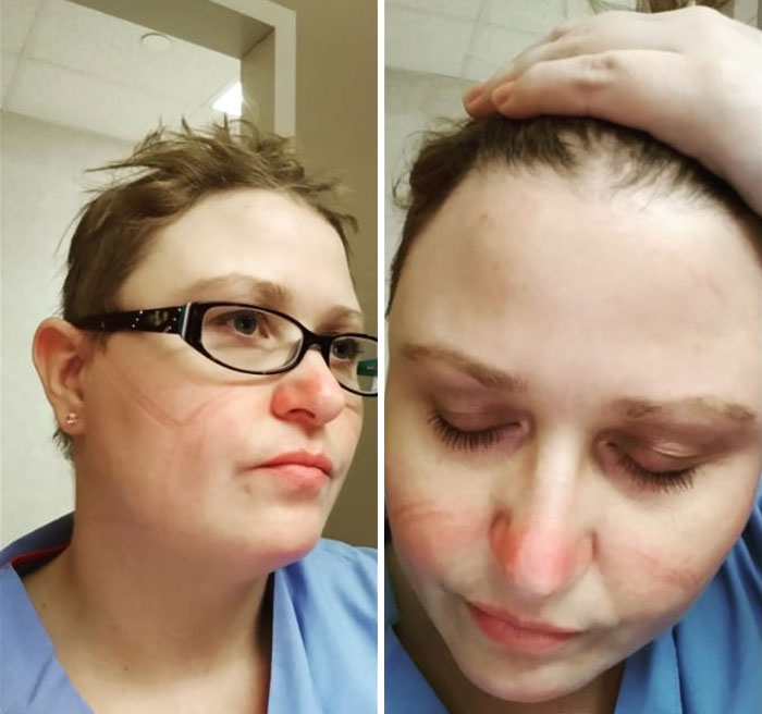 "N95 9ish Hours. I Did Get A 20 Minute Break And Went Outside For That Good City Air"