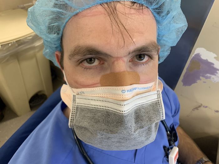 "Last Week, This Is Nick About To Intubate A Patient, Only Wearing A Patient’s Gown Because He Couldn’t Find Ppe And The Goggles Leave These Marks On His Face"