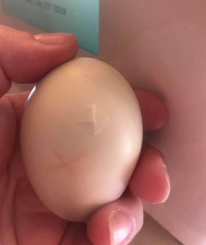 Kids Destroy Duck's Nest, Woman Saves Cracked Egg By Carrying It In Her Bra For 35 Days Kids Destroy Duck's Nest, Woman Saves Cracked Egg By Carrying It In Her Bra For 35 Days