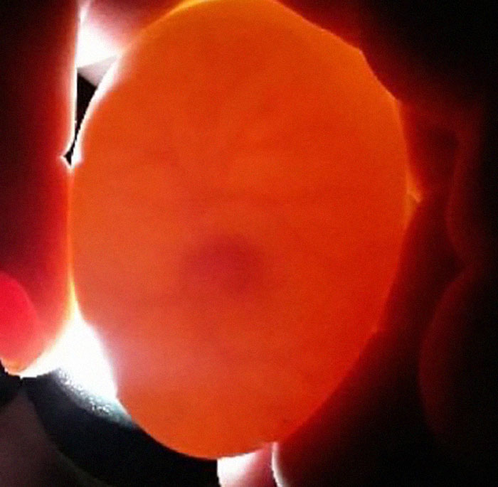 Kids Destroy Duck's Nest, Woman Saves Cracked Egg By Carrying It In Her Bra For 35 Days Kids Destroy Duck's Nest, Woman Saves Cracked Egg By Carrying It In Her Bra For 35 Days