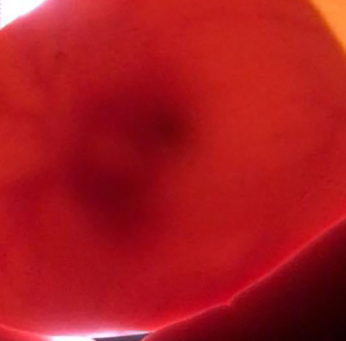 Kids Destroy Duck's Nest, Woman Saves Cracked Egg By Carrying It In Her Bra For 35 Days Kids Destroy Duck's Nest, Woman Saves Cracked Egg By Carrying It In Her Bra For 35 Days