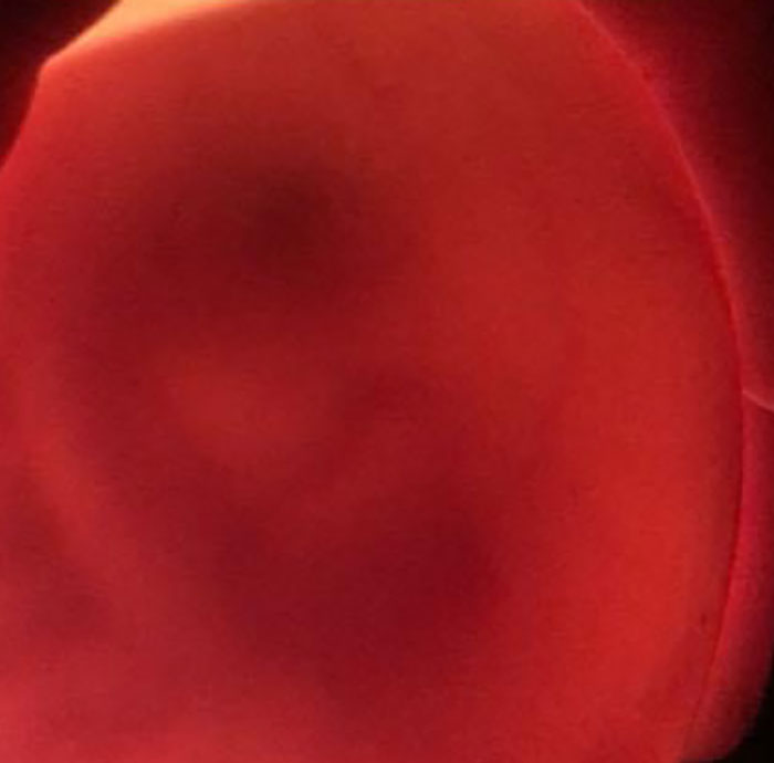 Kids Destroy Duck's Nest, Woman Saves Cracked Egg By Carrying It In Her Bra For 35 Days Kids Destroy Duck's Nest, Woman Saves Cracked Egg By Carrying It In Her Bra For 35 Days