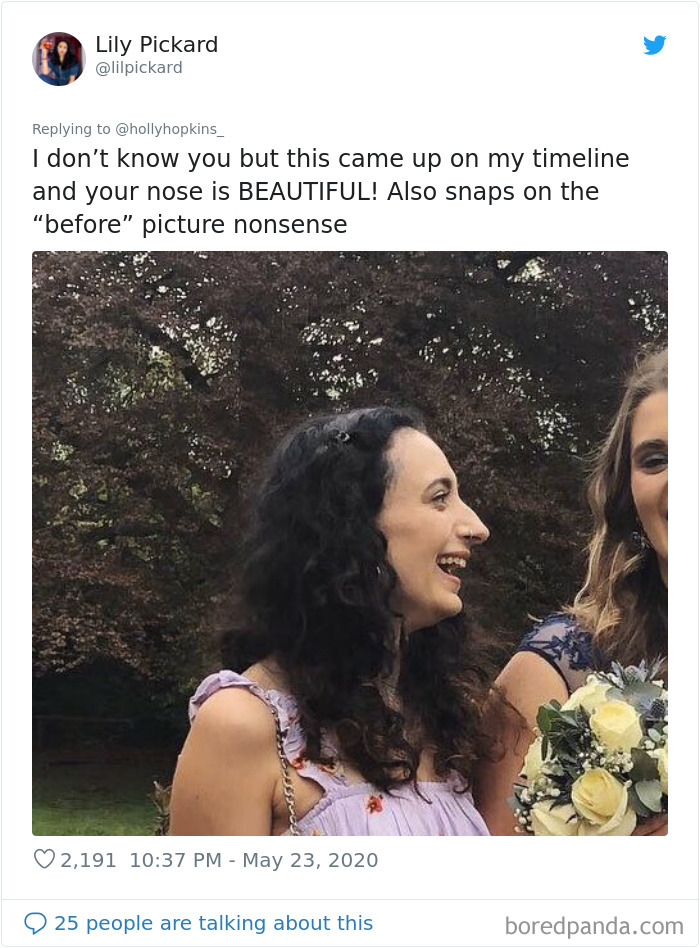 Noses-Look-Like-Before-Photos