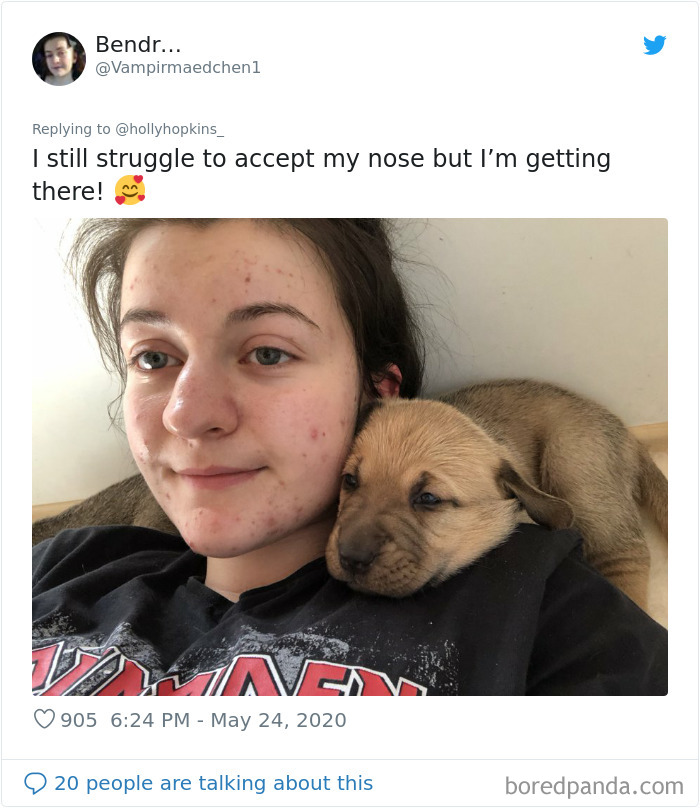 Noses-Look-Like-Before-Photos