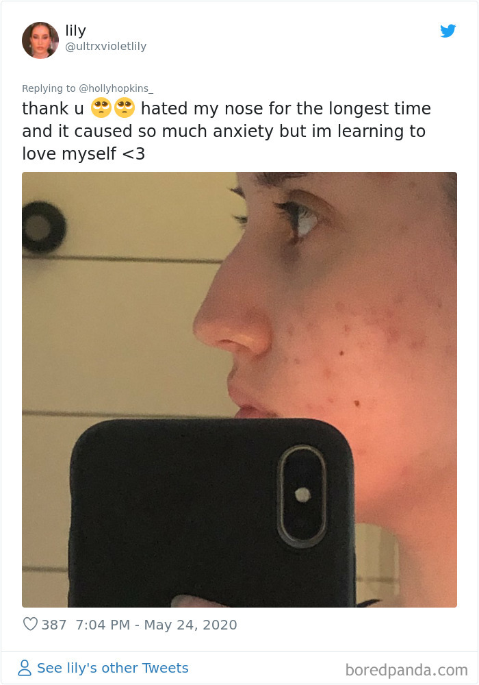 Noses-Look-Like-Before-Photos